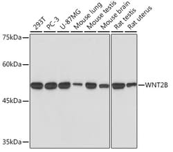 Invitrogen WNT2B Recombinant Rabbit Monoclonal Antibody (9M6O7) 100 &mu;L;