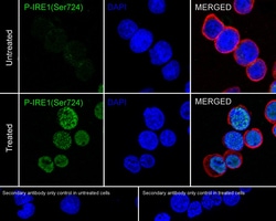 Invitrogen™ Phospho-IRE1 alpha (Ser724) Recombinant Rabbit Monoclonal Antibody (PSH03-35)