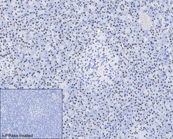 Invitrogen&trade;&nbsp;Phospho-IRE1 alpha (Ser724) Recombinant Rabbit Monoclonal Antibody (PSH03-35)