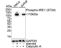 Invitrogen&trade;&nbsp;Phospho-IRE1 alpha (Ser724) Recombinant Rabbit Monoclonal Antibody (PSH03-35)