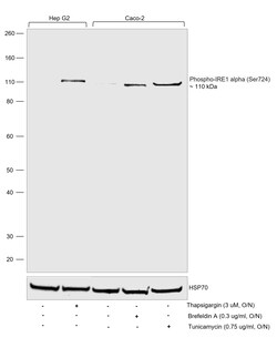 Invitrogen&trade;&nbsp;Phospho-IRE1 alpha (Ser724) Recombinant Rabbit Monoclonal Antibody (PSH03-35)