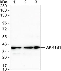 AKR1B1 Monoclonal Antibody (K92029_3F2), Invitrogen™