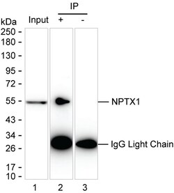 NPTX1 Monoclonal Antibody (K92045_10E7), Invitrogen&trade;