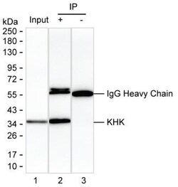 KHK Monoclonal Antibody (K52018_4C12), Invitrogen&trade;