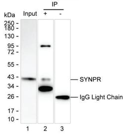 Invitrogen Synaptoporin Monoclonal Antibody (K49016_6D3), Invitrogen 200 &mu;L | Buy Online | Invitrogen&trade; | Fisher Scientific
