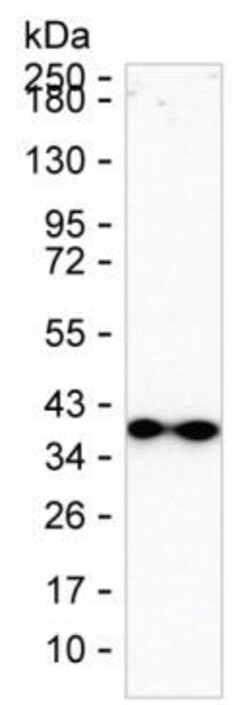 Synaptoporin Monoclonal Antibody (K49016_6D3), Invitrogen&trade;