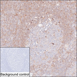 Invitrogen PKC beta Monoclonal Antibody (K40051_4D2), Invitrogen 200 &mu;L;