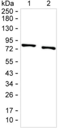 Invitrogen PKC beta Monoclonal Antibody (K40051_4D2), Invitrogen 200 &mu;L;