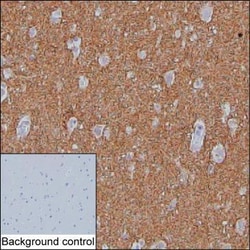 Invitrogen SV2A Monoclonal Antibody (K70011_6B6), Invitrogen 200 &mu;L | Buy Online | Invitrogen&trade; | Fisher Scientific