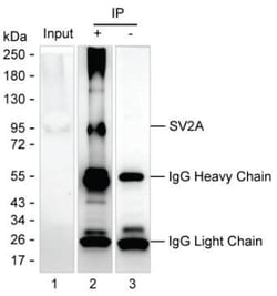 Invitrogen SV2A Monoclonal Antibody (K70011_6B6), Invitrogen 200 &mu;L | Buy Online | Invitrogen&trade; | Fisher Scientific