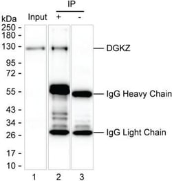 Invitrogen DGKZ Monoclonal Antibody (K49027_10E9), Invitrogen 200 &mu;L;