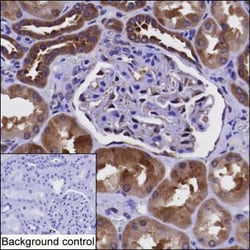 PKD2 Monoclonal Antibody (K49022_2E5), Invitrogen&trade;
