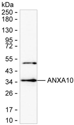Invitrogen Annexin A10 Monoclonal Antibody (K94033_8E3), Invitrogen 200