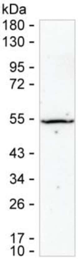 Invitrogen SSB Monoclonal Antibody (K70030_20C1), Invitrogen:Antibodies:Primary