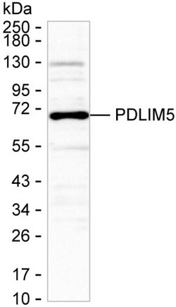 Invitrogen PDLIM5 Monoclonal Antibody (K56010_2H11), Invitrogen 50 &mu;L;