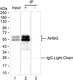 Invitrogen Fetuin A Monoclonal Antibody (K56007_7D7), Invitrogen 200 &mu;L | Buy Online | Invitrogen&trade; | Fisher Scientific