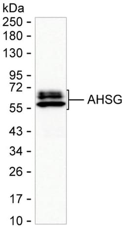Fetuin A Monoclonal Antibody (K56007_7D7), Invitrogen&trade;