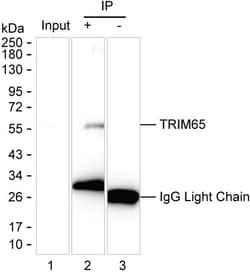 Invitrogen TRIM65 Monoclonal Antibody (K52045_2F4), Invitrogen 200 &mu;L | Buy Online | Invitrogen&trade; | Fisher Scientific