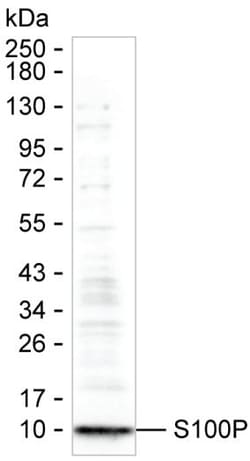 S100P Monoclonal Antibody (K40048_8D5), Invitrogen&trade;