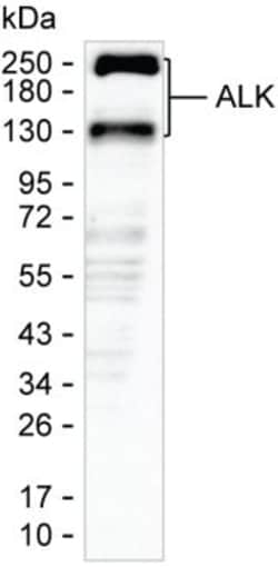 Invitrogen ALK Monoclonal Antibody (K40048_8D10), Invitrogen:Antibodies:Primary