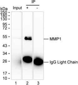 Invitrogen&trade;&nbsp;MMP1 Monoclonal Antibody (K29028_6B4), Invitrogen&trade;