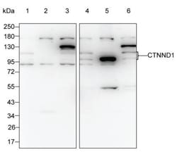 Invitrogen delta Catenin Monoclonal Antibody (K29002_1E2), Invitrogen 50