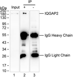 Invitrogen IQGAP2 Monoclonal Antibody (K06332_5D11), Invitrogen:Antibodies:Primary