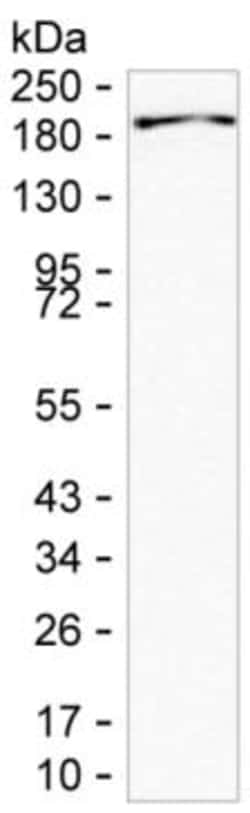 Invitrogen IQGAP2 Monoclonal Antibody (K06332_5D11), Invitrogen:Antibodies:Primary