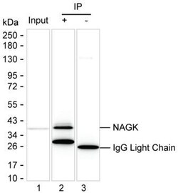 Invitrogen NAGK Monoclonal Antibody (K1E005_8C10), Invitrogen 200 &mu;L | Buy Online | Invitrogen&trade; | Fisher Scientific