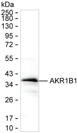 Invitrogen AKR1B1 Monoclonal Antibody (K92029_13G7), Invitrogen 50 &mu;L;
