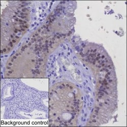 Invitrogen Galectin 2 Monoclonal Antibody (K70037_5D10), Invitrogen 200 &mu;L | Buy Online | Invitrogen&trade; | Fisher Scientific