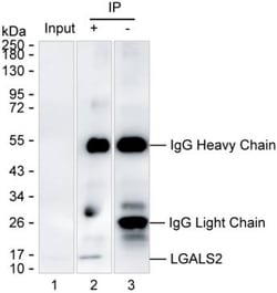 Invitrogen Galectin 2 Monoclonal Antibody (K70037_5D10), Invitrogen 200 &mu;L | Buy Online | Invitrogen&trade; | Fisher Scientific