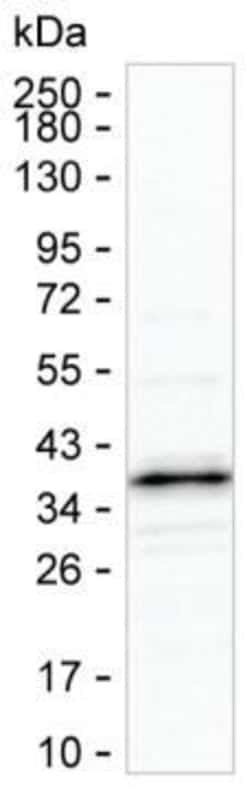 Invitrogen NDUFAF1 Monoclonal Antibody (K70037_11A8), Invitrogen 50 &mu;L;
