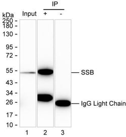 Invitrogen SSB Monoclonal Antibody (K70030_16C7), Invitrogen:Antibodies:Primary