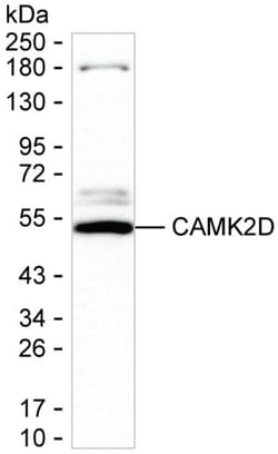 Invitrogen CaMKII delta Monoclonal Antibody (K52040_13E3), Invitrogen 50