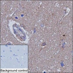 Invitrogen Ankyrin B Monoclonal Antibody (K52014_1E12), Invitrogen:Antibodies:Primary