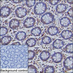 Invitrogen CHOP Monoclonal Antibody (K49008_20C12), Invitrogen 50 &mu;L;