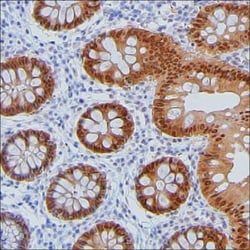 Invitrogen PPP1R14D Monoclonal Antibody (K49008_16C7), Invitrogen 50 &mu;g;