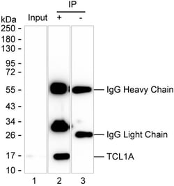 Invitrogen TCL1A Monoclonal Antibody (K40047_8H9), Invitrogen 200 &mu;L | Buy Online | Invitrogen&trade; | Fisher Scientific