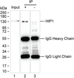 Invitrogen HIP1 Monoclonal Antibody (K40035_8D6), Invitrogen 200 &mu;L | Buy Online | Invitrogen&trade; | Fisher Scientific