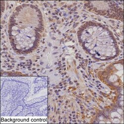 Invitrogen NYREN18 Monoclonal Antibody (K24024_14E2), Invitrogen 50 &mu;L | Buy Online | Invitrogen&trade; | Fisher Scientific