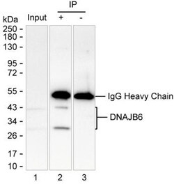 Invitrogen DNAJB6 Monoclonal Antibody (K24018_13E3), Invitrogen 200 &mu;L;