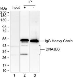 Invitrogen DNAJB6 Monoclonal Antibody (K24018_11G1), Invitrogen 200 &mu;L | Buy Online | Invitrogen&trade; | Fisher Scientific