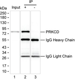 Invitrogen PKC delta Monoclonal Antibody (K06341_6F1), Invitrogen 50 &mu;L;