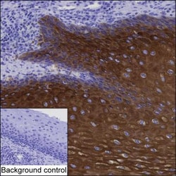 Invitrogen Cytokeratin 6A Monoclonal Antibody (K06323_15F4), Invitrogen:Antibodies:Primary