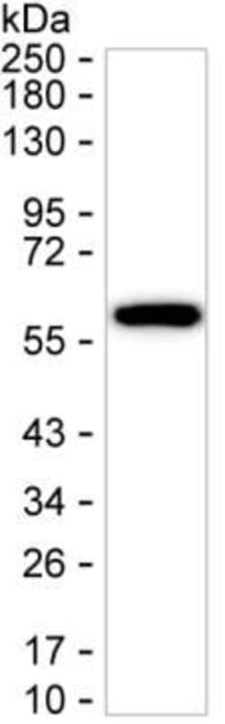Invitrogen Cytokeratin 6A Monoclonal Antibody (K06323_15F4), Invitrogen:Antibodies:Primary