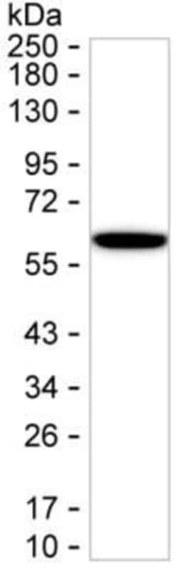 Invitrogen Cytokeratin 6A Monoclonal Antibody (K06323_11A10), Invitrogen