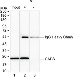 Invitrogen CAPS Monoclonal Antibody (K49040_2C5), Invitrogen 200 &mu;L;