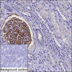 Invitrogen CD142 Monoclonal Antibody (K06319_4H12), Invitrogen 200 &mu;L;