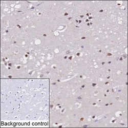 Invitrogen GDNF Monoclonal Antibody (K92005_2F3), Invitrogen 50 &mu;L;